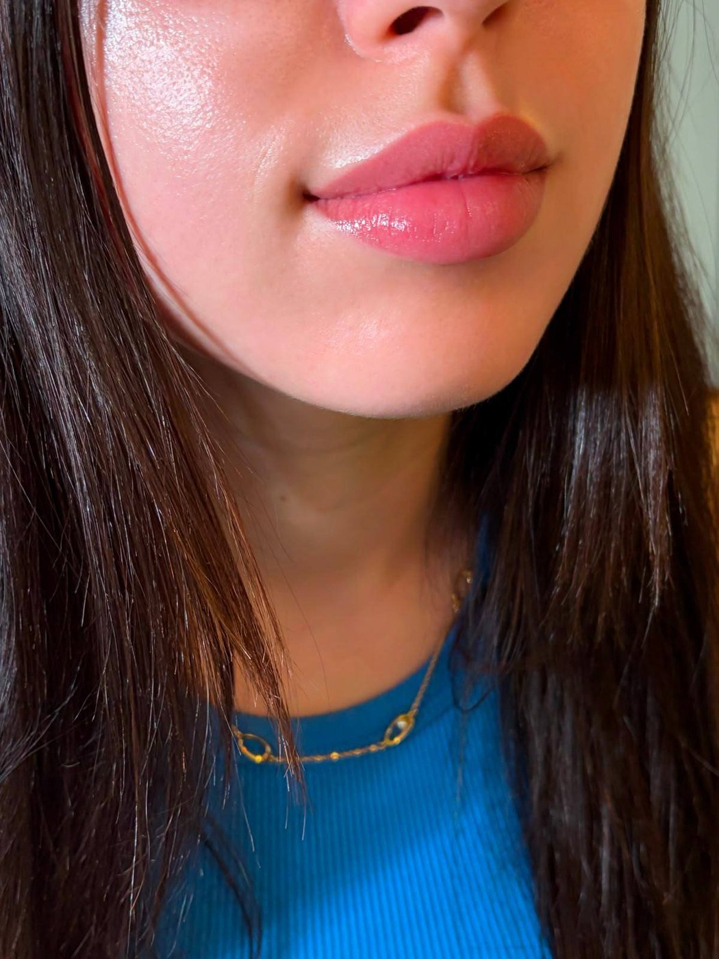 Healed Lips