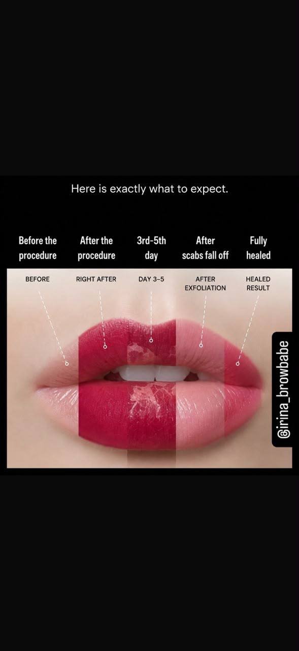 The healing process, day by day — before, after, day 3-5, after exfoliation, fully healed